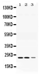 AK1 / Adenylate Kinase 1 Antibody - Western blot - Anti-Adenylate Kinase 1 Picoband Antibody