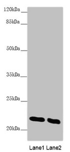 AK1 / Adenylate Kinase 1 Antibody - Western blot All Lanes: AK1 antibody at 0.51 ug/ml Lane 1: Mouse skeletal muscle tissue Lane 2: Mouse heart tissue Secondary Goat polyclonal to rabbit IgG at 1/10000 dilution Predicted band size: 22 kDa Observed band size: 22 kDa