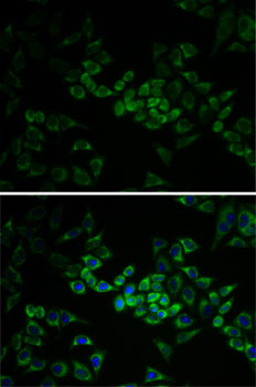 AK1 / Adenylate Kinase 1 Antibody - Immunofluorescence analysis of HeLa cells using AK1 antibody. Blue: DAPI for nuclear staining.