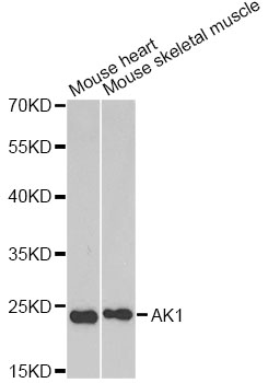 AK1 / Adenylate Kinase 1 Antibody - Western blot analysis of extracts of various cell lines, using AK1 antibody at 1:1000 dilution. The secondary antibody used was an HRP Goat Anti-Rabbit IgG (H+L) at 1:10000 dilution. Lysates were loaded 25ug per lane and 3% nonfat dry milk in TBST was used for blocking.