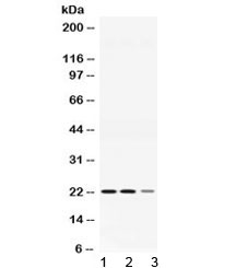 AK1 / Adenylate Kinase 1 Antibody - Western blot testing of 1) rat skeletal muscle, 2) mouse heart and 3) human COLO320 lysate with ADO antibody at 0.5ug/ml. Predicted molecular weight ~22 kDa.