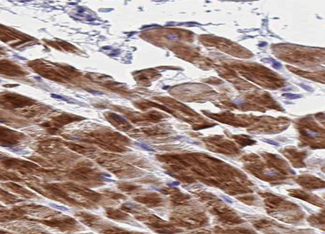 AK1 / Adenylate Kinase 1 Antibody - 1:100 staining human skeletal muscle tissue by IHC-P. The tissue was formaldehyde fixed and a heat mediated antigen retrieval step in citrate buffer was performed. The tissue was then blocked and incubated with the antibody for 1.5 hours at 22°C. An HRP conjugated goat anti-rabbit antibody was used as the secondary.