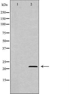 AK1 / Adenylate Kinase 1 Antibody - Western blot analysis of HEK293 lysate using AK1 antibody. The lane on the left is treated with the antigen-specific peptide.
