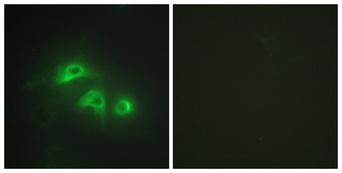 AK1 / Adenylate Kinase 1 Antibody - Peptide - + Immunofluorescence analysis of HepG2 cells, using KAD1 antibody.