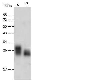 AK1 / Adenylate Kinase 1 Antibody - Anti-AK1 rabbit polyclonal antibody at 1:500 dilution. Lane A: Rat Heart tissue lysate. Lane B: Rat Brain tissue lysate. Lysates/proteins at 30 ug per lane. Secondary: Goat Anti-Rabbit IgG (H+L)/HRP at 1/10000 dilution. Developed using the ECL technique. Performed under reducing conditions. Predicted band size: 22 kDa. Observed band size: 22 kDa.