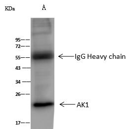 AK1 / Adenylate Kinase 1 Antibody - ratAK1 was immunoprecipitated using: Lane A: 0.5 mg HepG2 Whole Cell Lysate. 2 uL anti-ratAK1 rabbit polyclonal antibody and 60 ug of Immunomagnetic beads Protein A/G. Primary antibody: Anti-ratAK1 rabbit polyclonal antibody, at 1:100 dilution. Secondary antibody: Goat Anti-Rabbit IgG (H+L)/HRP at 1/10000 dilution. Developed using the ECL technique. Performed under reducing conditions. Predicted band size: 22 kDa. Observed band size: 22 kDa.