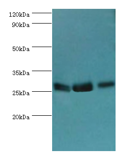 AK2 / Adenylate Kinase 2 Antibody - Western blot. All lanes: Adenylate kinase 2, mitochondrial antibody at 5 ug/ml. Lane 1: HeLa whole cell lysate. Lane 2: mouse kidney tissue. Lane 3: mouse small intestine tissue. Secondary antibody: Goat polyclonal to rabbit at 1:10000 dilution. Predicted band size: 26 kDa. Observed band size: 26 kDa.