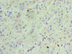 AK2 / Adenylate Kinase 2 Antibody - Immunohistochemistry of paraffin-embedded human liver tissue using AK2 Antibody at dilution of 1:100