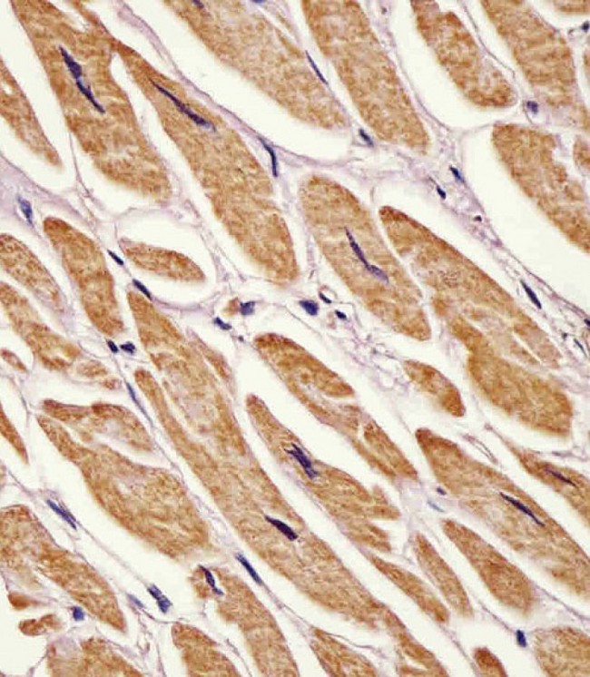 AK2 / Adenylate Kinase 2 Antibody - Antibody staining Zebrafish ak2 in human heart tissue sections by Immunohistochemistry (IHC-P - paraformaldehyde-fixed, paraffin-embedded sections). Tissue was fixed with formaldehyde and blocked with 3% BSA for 0. 5 hour at room temperature; antigen retrieval was by heat mediation with a citrate buffer (pH 6). Samples were incubated with primary antibody (1:25) for 1 hours at 37°C. A undiluted biotinylated goat polyvalent antibody was used as the secondary antibody.