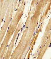 AK2 / Adenylate Kinase 2 Antibody - Antibody staining Zebrafish ak2 in zebra fish body tissue sections by Immunohistochemistry (IHC-P - paraformaldehyde-fixed, paraffin-embedded sections). Tissue was fixed with formaldehyde and blocked with 3% BSA for 0. 5 hour at room temperature; antigen retrieval was by heat mediation with a citrate buffer (pH 6). Samples were incubated with primary antibody (1:25) for 1 hours at 37°C. A undiluted biotinylated goat polyvalent antibody was used as the secondary antibody.
