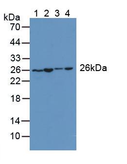 AK2 / Adenylate Kinase 2 Antibody - Western Blot; Sample: Lane1: Rat Stomach Tissue; Lane2: Rat Kidney Tissue; Lane3: Rat Heart Tissue; Lane4: Rat Liver Tissue.