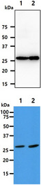 AK2 / Adenylate Kinase 2 Antibody - The Tissue lysates (40ug) were resolved by SDS-PAGE, transferred to PVDF membrane and probed with anti-human AK2 antibody (1:1000). Proteins were visualized using a goat anti-mouse secondary antibody conjugated to HRP and an ECL detection system. Lane 1.: Kidney tissue lysate Lane 2.: Liver tissue lysate The cell lysates (40ug) were resolved by SDS-PAGE, transferred to PVDF membrane and probed with anti-human AK2 antibody (1:1000). Proteins were visualized using a goat anti-mouse secondary antibody conjugated to HRP and an ECL detection system. Lane 1.: HepG2 cell lysate Lane 2.: NIH/3T3 cell lysate