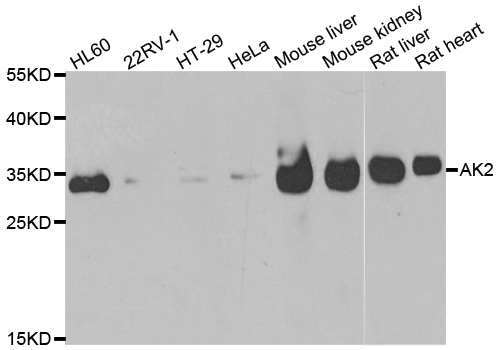 AK2 / Adenylate Kinase 2 Antibody - Western blot analysis of extracts of various cell lines.