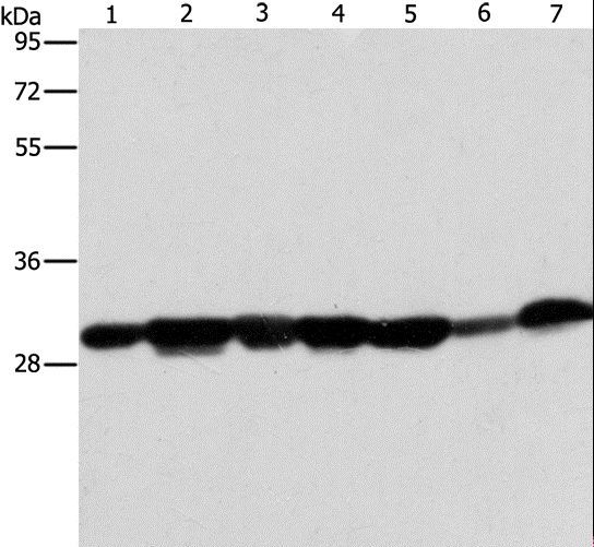 AK2 / Adenylate Kinase 2 Antibody - Western blot analysis of Human placenta tissue and A549 cell, mouse brain tissue and hepG2 cell, Raji cell and human fetal liver tissue, HeLa cell, using AK2 Polyclonal Antibody at dilution of 1:300.