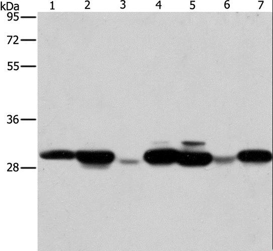AK2 / Adenylate Kinase 2 Antibody - Western blot analysis of Human placenta tissue and A549 cell, mouse brain tissue and hepG2 cell, Raji cell and human fetal liver tissue, HeLa cell, using AK2 Polyclonal Antibody at dilution of 1:250.