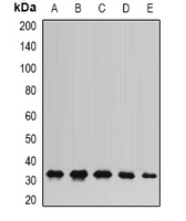 AK2 / Adenylate Kinase 2 Antibody - Western blot analysis of AK2 expression in HT29 (A); HeLa (B); mouse liver (C); mouse kidney (D); rat heart (E) whole cell lysates.