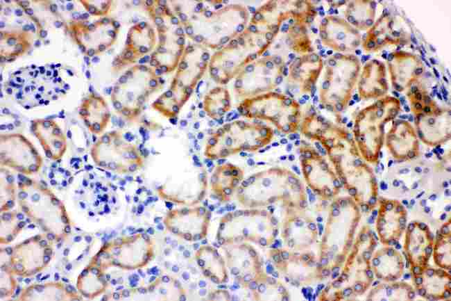 AK2 / Adenylate Kinase 2 Antibody - AK2 was detected in paraffin-embedded sections of mouse kidney tissues using rabbit anti- AK2 Antigen Affinity purified polyclonal antibody