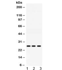 AK2 / Adenylate Kinase 2 Antibody - Western blot testing of 1) rat liver, 2) mouse kidney and 3) human HeLa lysate with AK2 antibody at 0.5ug/ml. Predicted molecular weight ~26 kDa.