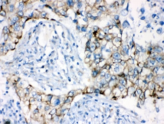 AK2 / Adenylate Kinase 2 Antibody - IHC testing of FFPE human lung with AK2 antibody at 1ug/ml. HIER: steam sections in pH6 citrate buffer for 20 min.