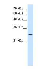 AK2 / Adenylate Kinase 2 Antibody - HepG2 cell lysate. Antibody concentration: 2.5 ug/ml. Gel concentration: 12%.  This image was taken for the unconjugated form of this product. Other forms have not been tested.