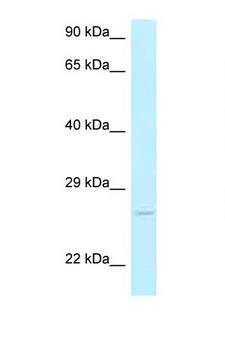 AK3 / Adenylate Kinase 3 Antibody - AK3 antibody Western blot of Mouse Liver lysate. Antibody concentration 1 ug/ml.  This image was taken for the unconjugated form of this product. Other forms have not been tested.