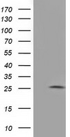 AK3 / Adenylate Kinase 3 Antibody - HEK293T cells were transfected with the pCMV6-ENTRY control. (Left lane) or pCMV6-ENTRY AK3. (Right lane) cDNA for 48 hrs and lysed
