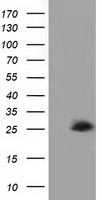 AK3 / Adenylate Kinase 3 Antibody - HEK293T cells were transfected with the pCMV6-ENTRY control (Left lane) or pCMV6-ENTRY AK3 (Right lane) cDNA for 48 hrs and lysed. Equivalent amounts of cell lysates (5 ug per lane) were separated by SDS-PAGE and immunoblotted with anti-AK3.