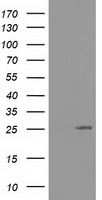 AK3 / Adenylate Kinase 3 Antibody - HEK293T cells were transfected with the pCMV6-ENTRY control (Left lane) or pCMV6-ENTRY AK3 (Right lane) cDNA for 48 hrs and lysed. Equivalent amounts of cell lysates (5 ug per lane) were separated by SDS-PAGE and immunoblotted with anti-AK3.