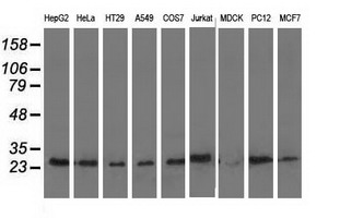 AK3 / Adenylate Kinase 3 Antibody - Western blot of extracts (35 ug) from 9 different cell lines by using anti-AK3 monoclonal antibody.