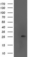 AK4 / Adenylate Kinase 4 Antibody - HEK293T cells were transfected with the pCMV6-ENTRY control (Left lane) or pCMV6-ENTRY AK4 (Right lane) cDNA for 48 hrs and lysed. Equivalent amounts of cell lysates (5 ug per lane) were separated by SDS-PAGE and immunoblotted with anti-AK4.