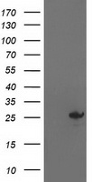 AK4 / Adenylate Kinase 4 Antibody - HEK293T cells were transfected with the pCMV6-ENTRY control (Left lane) or pCMV6-ENTRY AK4 (Right lane) cDNA for 48 hrs and lysed. Equivalent amounts of cell lysates (5 ug per lane) were separated by SDS-PAGE and immunoblotted with anti-AK4.