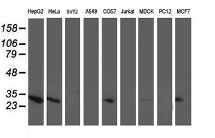 AK4 / Adenylate Kinase 4 Antibody - Western blot of extracts (35 ug) from 9 different cell lines by using anti-AK4 monoclonal antibody.