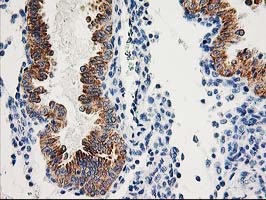 AK4 / Adenylate Kinase 4 Antibody - IHC of paraffin-embedded Human endometrium tissue using anti-AK4 mouse monoclonal antibody.