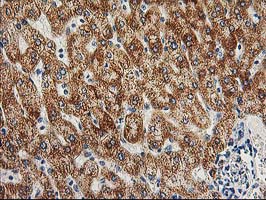AK4 / Adenylate Kinase 4 Antibody - IHC of paraffin-embedded Human liver tissue using anti-AK4 mouse monoclonal antibody.