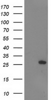 AK4 / Adenylate Kinase 4 Antibody - HEK293T cells were transfected with the pCMV6-ENTRY control (Left lane) or pCMV6-ENTRY AK4 (Right lane) cDNA for 48 hrs and lysed. Equivalent amounts of cell lysates (5 ug per lane) were separated by SDS-PAGE and immunoblotted with anti-AK4.