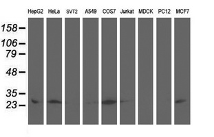AK4 / Adenylate Kinase 4 Antibody - Western blot of extracts (35 ug) from 9 different cell lines by using anti-AK4 monoclonal antibody.