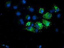 AK4 / Adenylate Kinase 4 Antibody - Anti-AK4 mouse monoclonal antibody immunofluorescent staining of COS7 cells transiently transfected by pCMV6-ENTRY AK4.