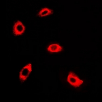 AK4 / Adenylate Kinase 4 Antibody - Immunofluorescent analysis of AK4 staining in A549 cells. Formalin-fixed cells were permeabilized with 0.1% Triton X-100 in TBS for 5-10 minutes and blocked with 3% BSA-PBS for 30 minutes at room temperature. Cells were probed with the primary antibody in 3% BSA-PBS and incubated overnight at 4 deg C in a humidified chamber. Cells were washed with PBST and incubated with a DyLight 594-conjugated secondary antibody (red) in PBS at room temperature in the dark.