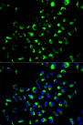 AK4 / Adenylate Kinase 4 Antibody - Immunofluorescence analysis of A549 cells using AK4 antibody. Blue: DAPI for nuclear staining.