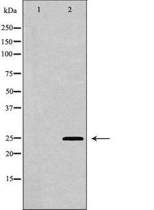 AK4 / Adenylate Kinase 4 Antibody - Western blot analysis of HeLa whole cells lysates using AK4 antibody. The lane on the left is treated with the antigen-specific peptide.