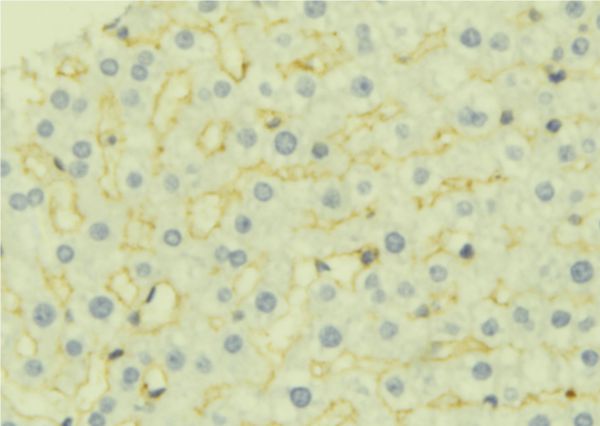 AK4 / Adenylate Kinase 4 Antibody - 1:100 staining mouse liver tissue by IHC-P. The sample was formaldehyde fixed and a heat mediated antigen retrieval step in citrate buffer was performed. The sample was then blocked and incubated with the antibody for 1.5 hours at 22°C. An HRP conjugated goat anti-rabbit antibody was used as the secondary.