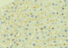 AK4 / Adenylate Kinase 4 Antibody - 1:100 staining mouse liver tissue by IHC-P. The sample was formaldehyde fixed and a heat mediated antigen retrieval step in citrate buffer was performed. The sample was then blocked and incubated with the antibody for 1.5 hours at 22°C. An HRP conjugated goat anti-rabbit antibody was used as the secondary.