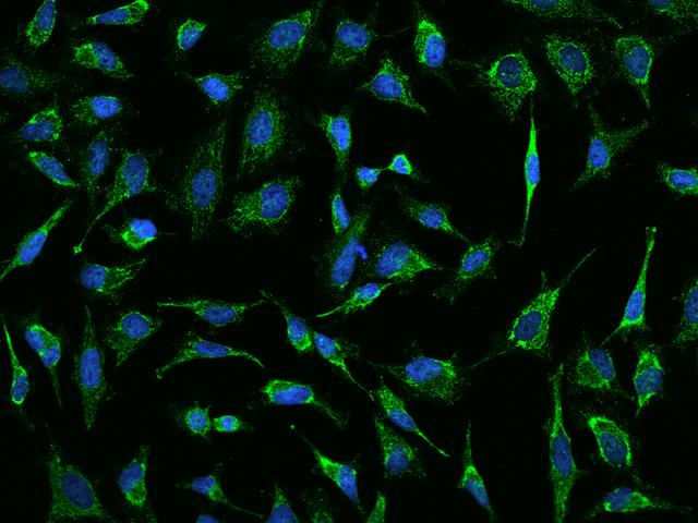 AK4 / Adenylate Kinase 4 Antibody - Immunofluorescence staining of AK4 in Hela cells. Cells were fixed with 4% PFA, permeabilzed with 0.1% Triton X-100 in PBS, blocked with 10% serum, and incubated with rabbit anti-Human AK4 polyclonal antibody (dilution ratio 1:200) at 4°C overnight. Then cells were stained with the Alexa Fluor 488-conjugated Goat Anti-rabbit IgG secondary antibody (green) and counterstained with DAPI (blue). Positive staining was localized to Cytoplasm.