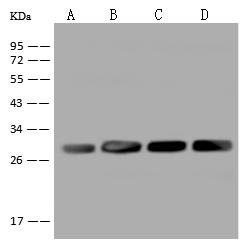 AK4 / Adenylate Kinase 4 Antibody - Anti-AK4 rabbit polyclonal antibody at 1:500 dilution. Lane A: MCF-7 Whole Cell Lysate. Lane B: HepG2 Whole Cell Lysate. Lane C: Raji Whole Cell Lysate. Lane D: A431 Whole Cell Lysate. Lysates/proteins at 30 ug per lane. Secondary: Goat Anti-Rabbit IgG (H+L)/HRP at 1/10000 dilution. Developed using the ECL technique. Performed under reducing conditions. Predicted band size: 25 kDa. Observed band size: 27 kDa.