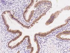 AK4 / Adenylate Kinase 4 Antibody - Immunochemical staining of human AK4 in human gallbladder with rabbit polyclonal antibody at 1:100 dilution, formalin-fixed paraffin embedded sections.