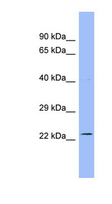 AK4 / Adenylate Kinase 4 Antibody - AK4 antibody Western blot of Fetal Stomach lysate. This image was taken for the unconjugated form of this product. Other forms have not been tested.