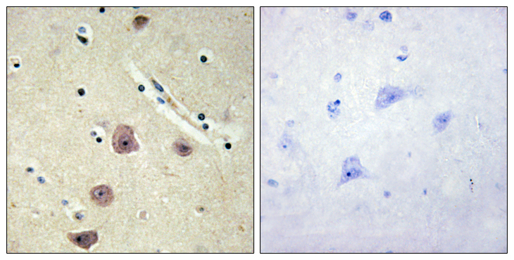 AK5 / Adenylate Kinase 5 Antibody - Immunohistochemistry analysis of paraffin-embedded human brain tissue, using AK5 Antibody. The picture on the right is blocked with the synthesized peptide.