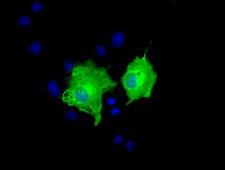 AK5 / Adenylate Kinase 5 Antibody - Anti-AK5 mouse monoclonal antibody  immunofluorescent staining of COS7 cells transiently transfected by pCMV6-ENTRY AK5.