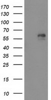 AK5 / Adenylate Kinase 5 Antibody - HEK293T cells were transfected with the pCMV6-ENTRY control (Left lane) or pCMV6-ENTRY AK5 (Right lane) cDNA for 48 hrs and lysed. Equivalent amounts of cell lysates (5 ug per lane) were separated by SDS-PAGE and immunoblotted with anti-AK5.