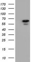 AK5 / Adenylate Kinase 5 Antibody - HEK293T cells were transfected with the pCMV6-ENTRY control (Left lane) or pCMV6-ENTRY AK5 (Right lane) cDNA for 48 hrs and lysed. Equivalent amounts of cell lysates (5 ug per lane) were separated by SDS-PAGE and immunoblotted with anti-AK5.